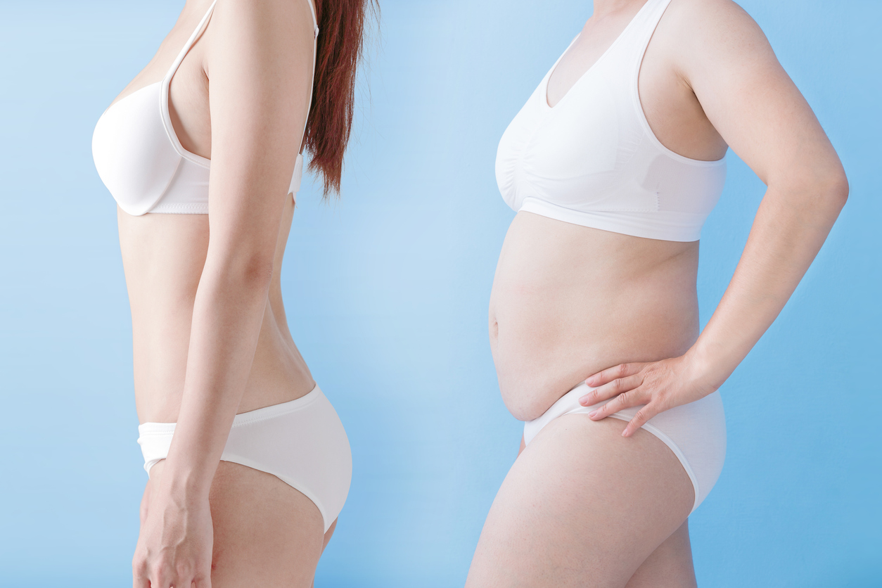 腸内フローラダイエットのやり方とは?痩せ菌を増やす方法を解説